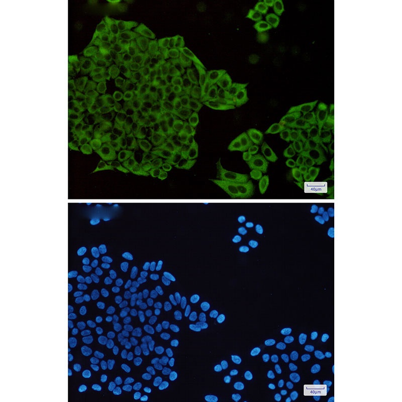 MEK1/2 Rabbit mAb