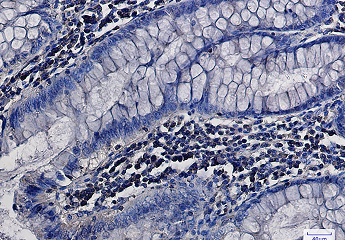 MEK1/2 Rabbit mAb