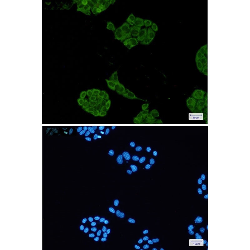 LDHA Antibody