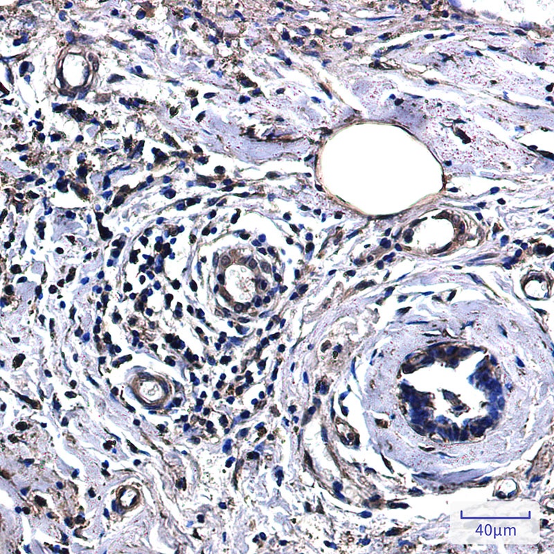 LDHA Antibody