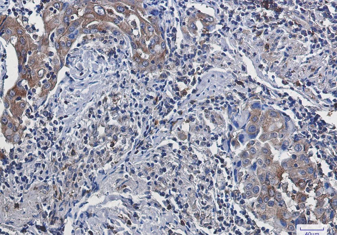 ACSL4 Antibody
