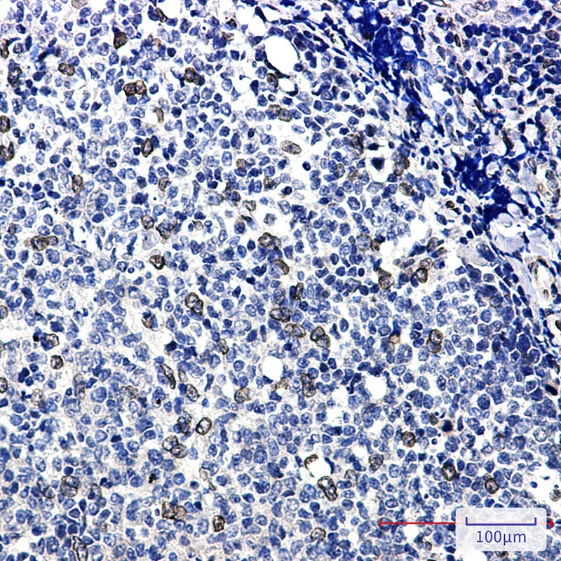 E2F1 Antibody