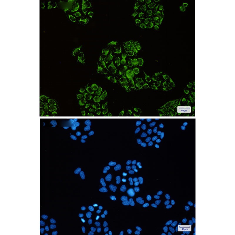 CS Antibody