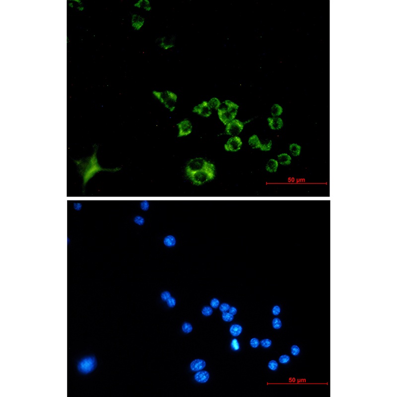 Cathepsin B Rabbit mAb