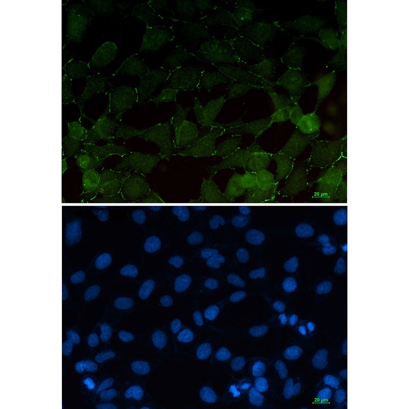 beta Catenin Rabbit mAb