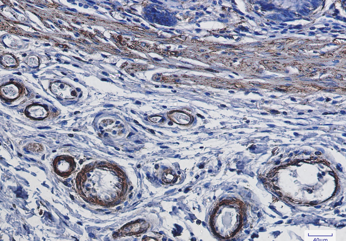 ACTA2 Antibody