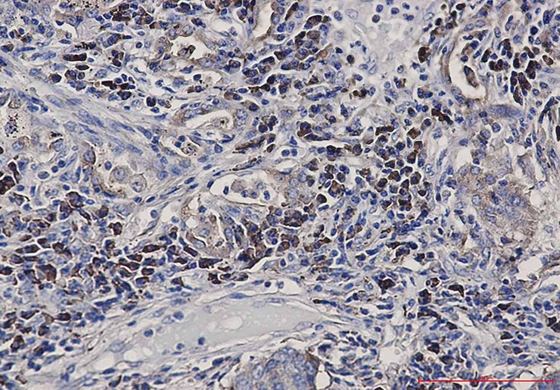 ALPL Antibody