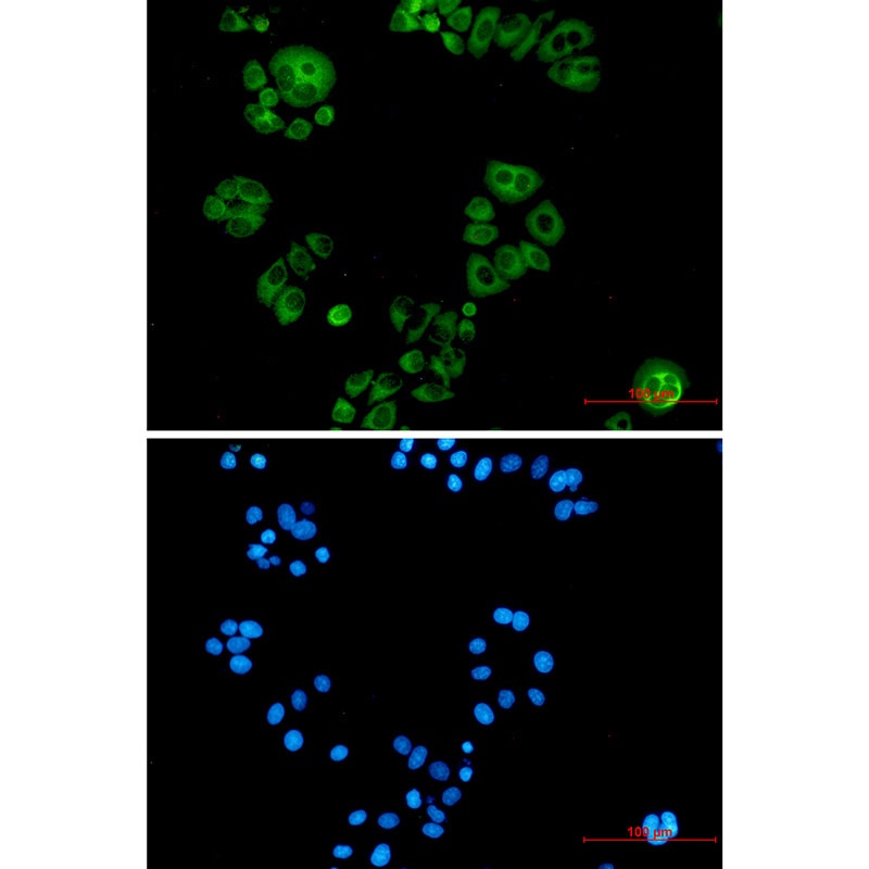ALPL Antibody