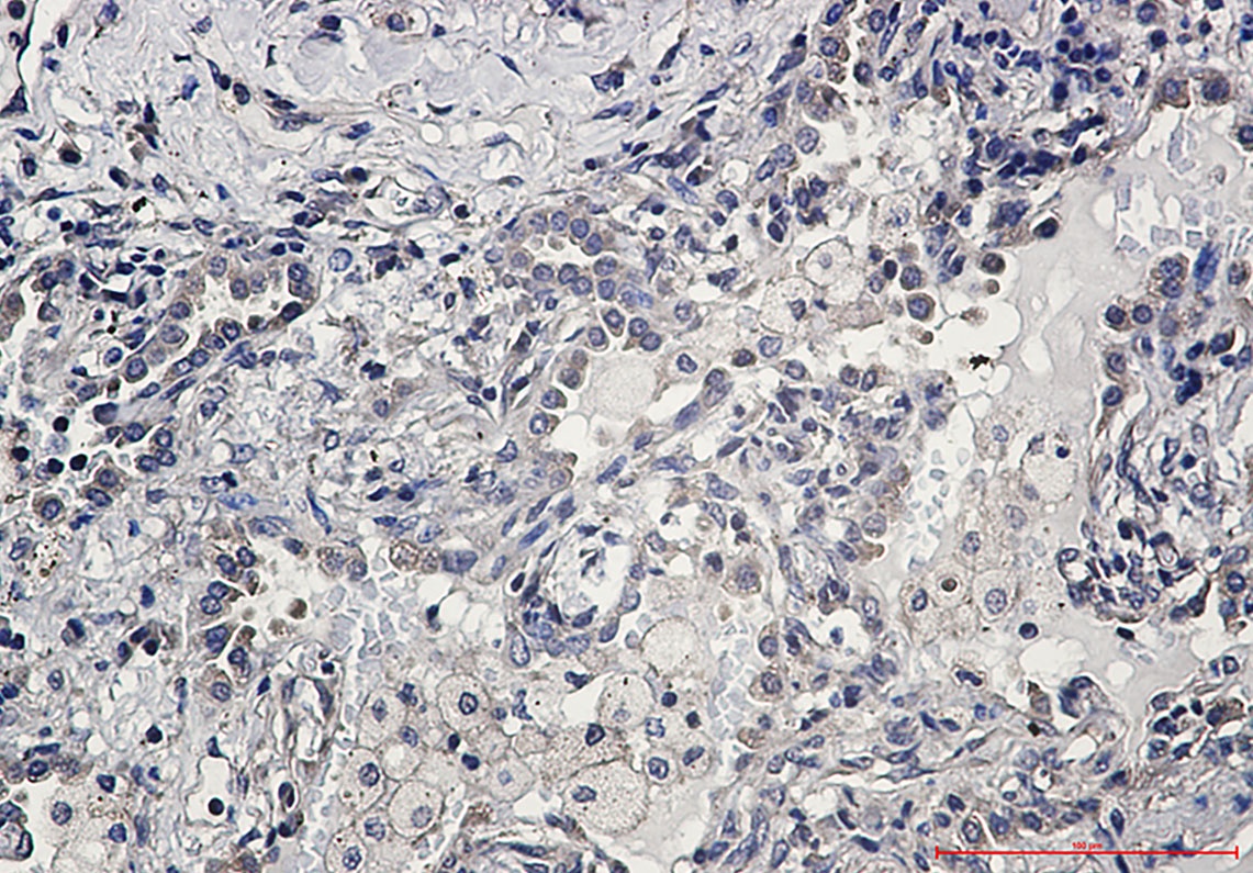 AKT Rabbit mAb