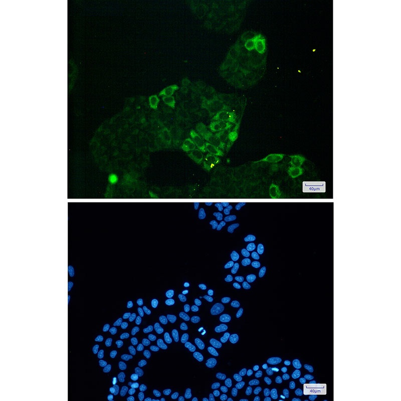 [KD] Cyclin B1 Rabbit mAb