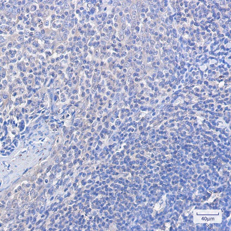 FOXO1 Antibody