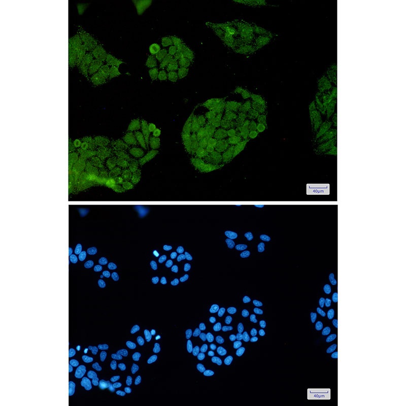 FOXO1 Antibody