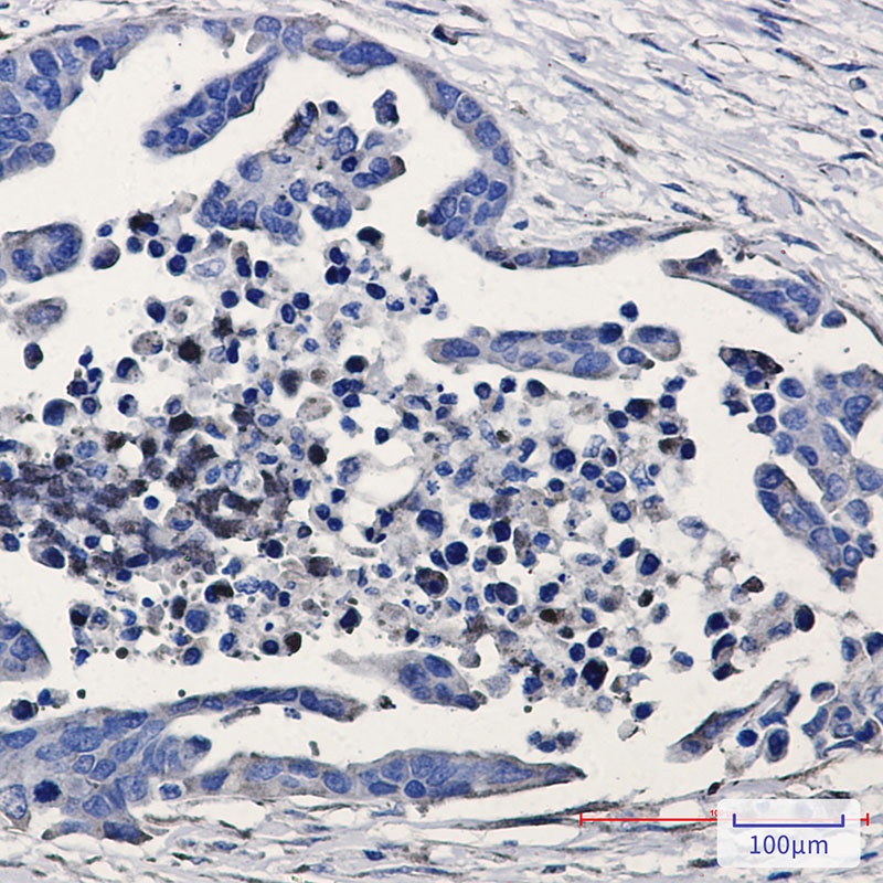 GSK3B Antibody