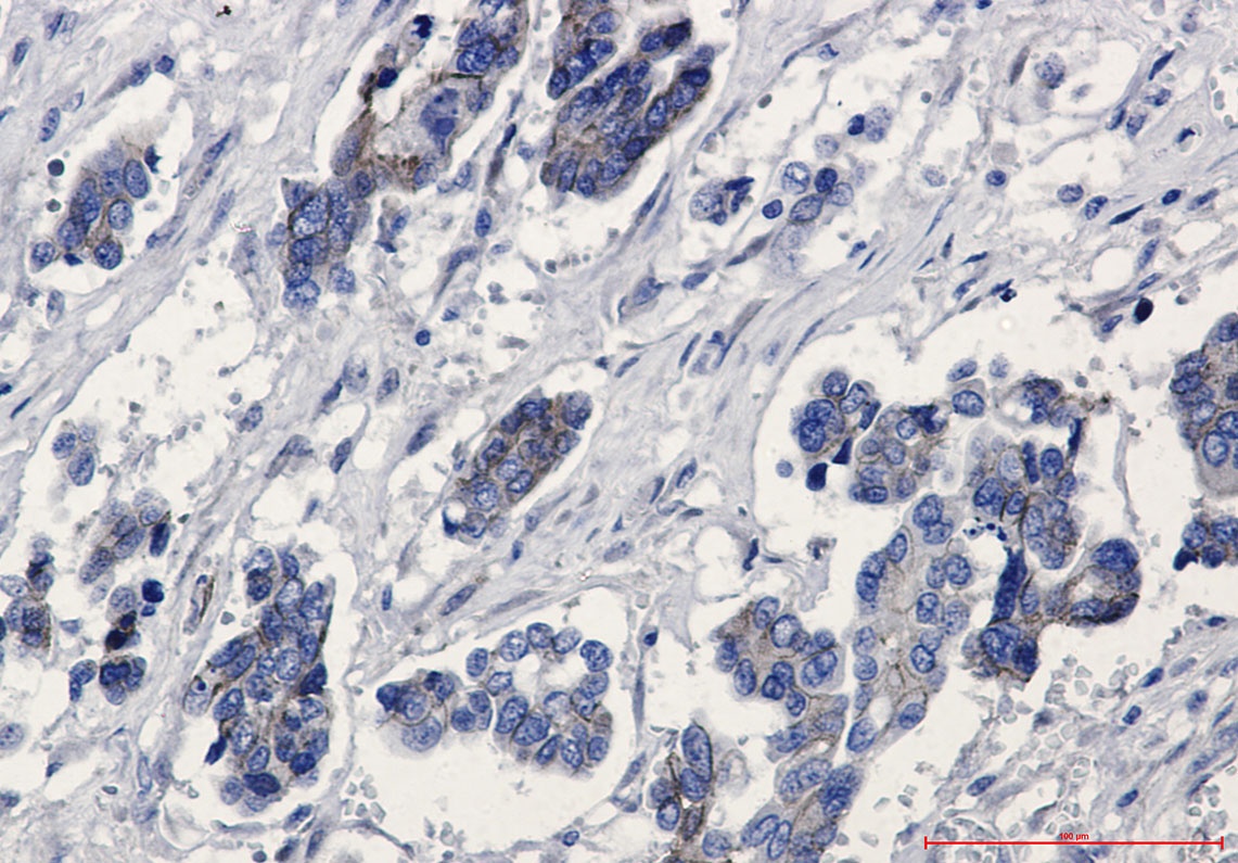 beta Catenin Rabbit mAb