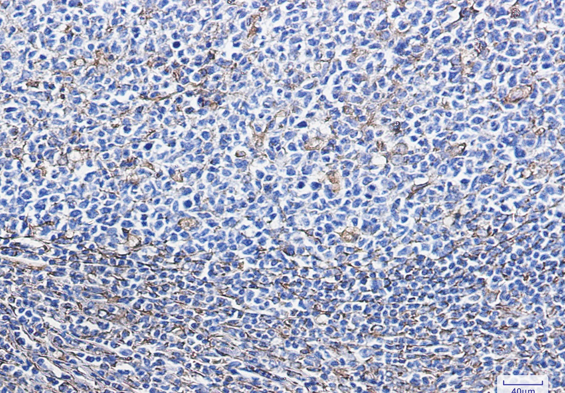 Vimentin Rabbit mAb