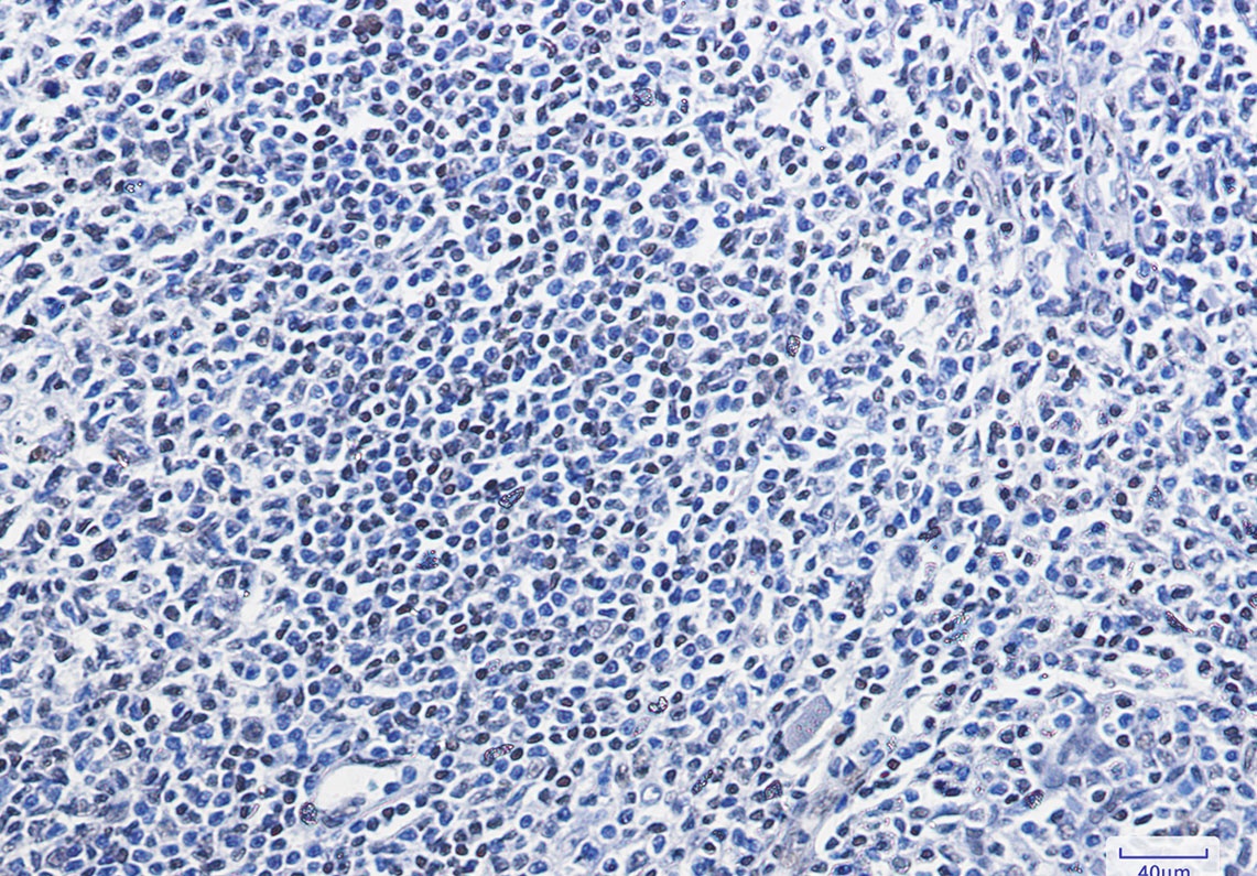 HMGB1 Antibody
