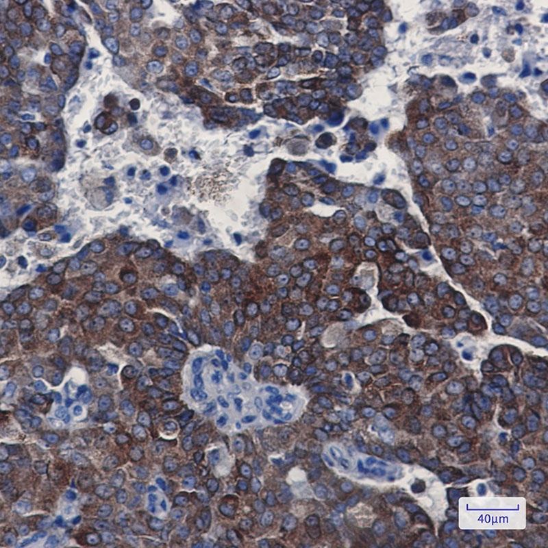 BCL2 Antibody