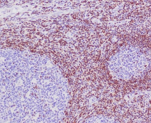 Bcl2 Rabbit pAb