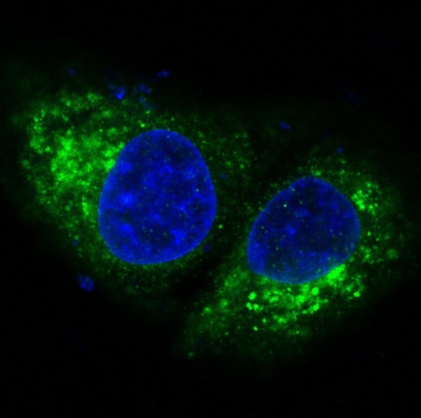 BAK1 Antibody