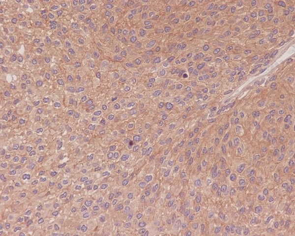 NF-KB p65 Rabbit pAb