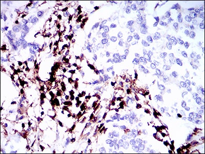 CD45 Mouse mAb