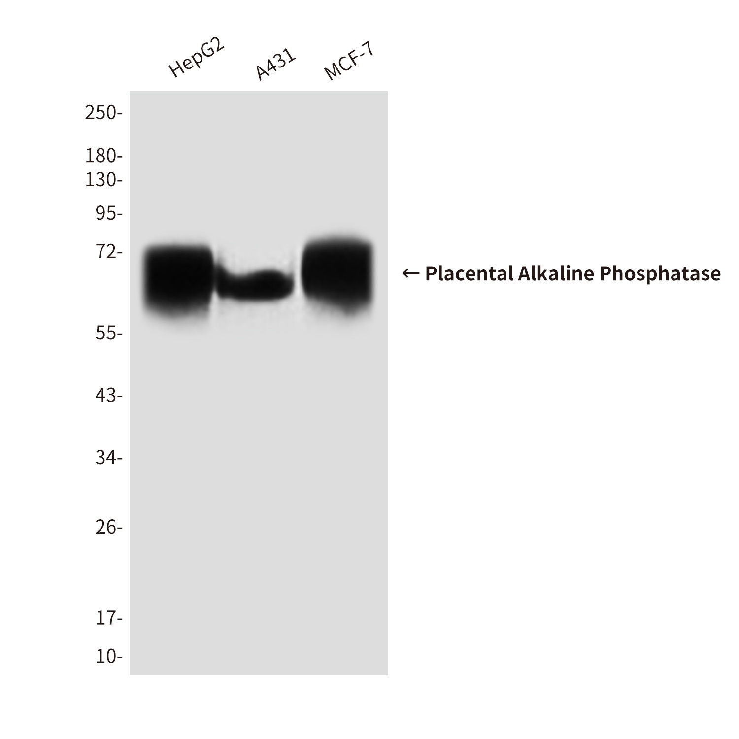 Placental Alkaline Phosphatase Mouse mAb