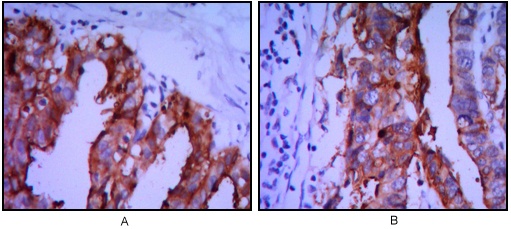 Placental Alkaline Phosphatase Mouse mAb