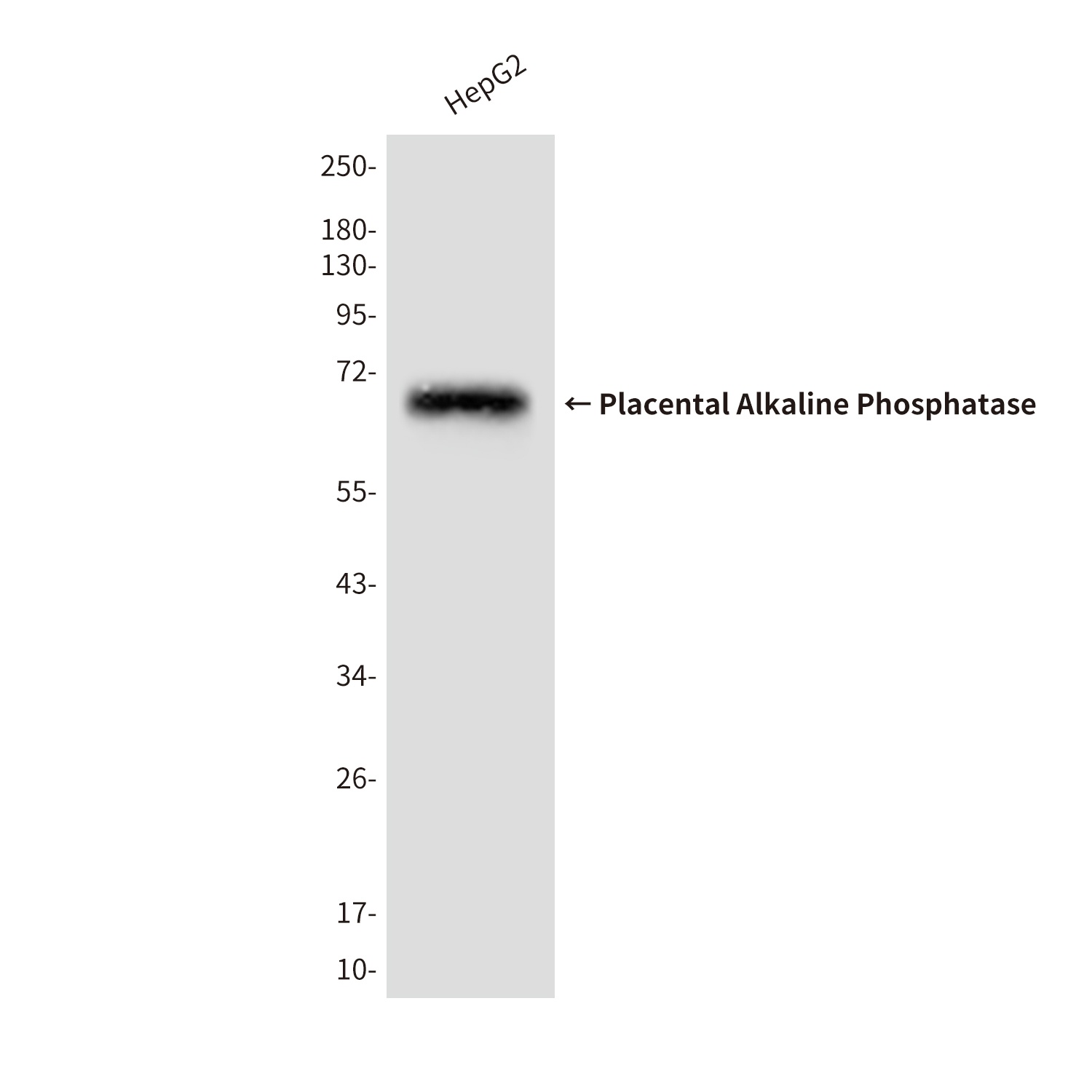 Placental Alkaline Phosphatase Mouse mAb