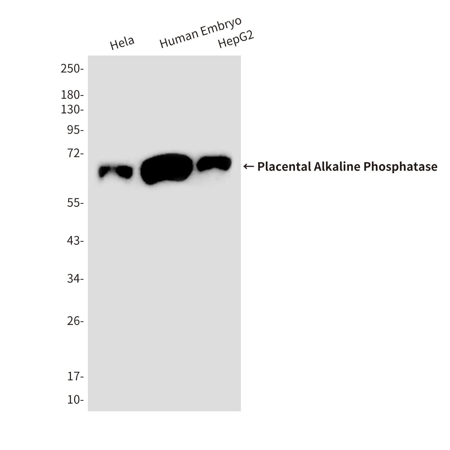 Placental Alkaline Phosphatase Mouse mAb