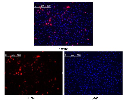 LIN28A Antibody