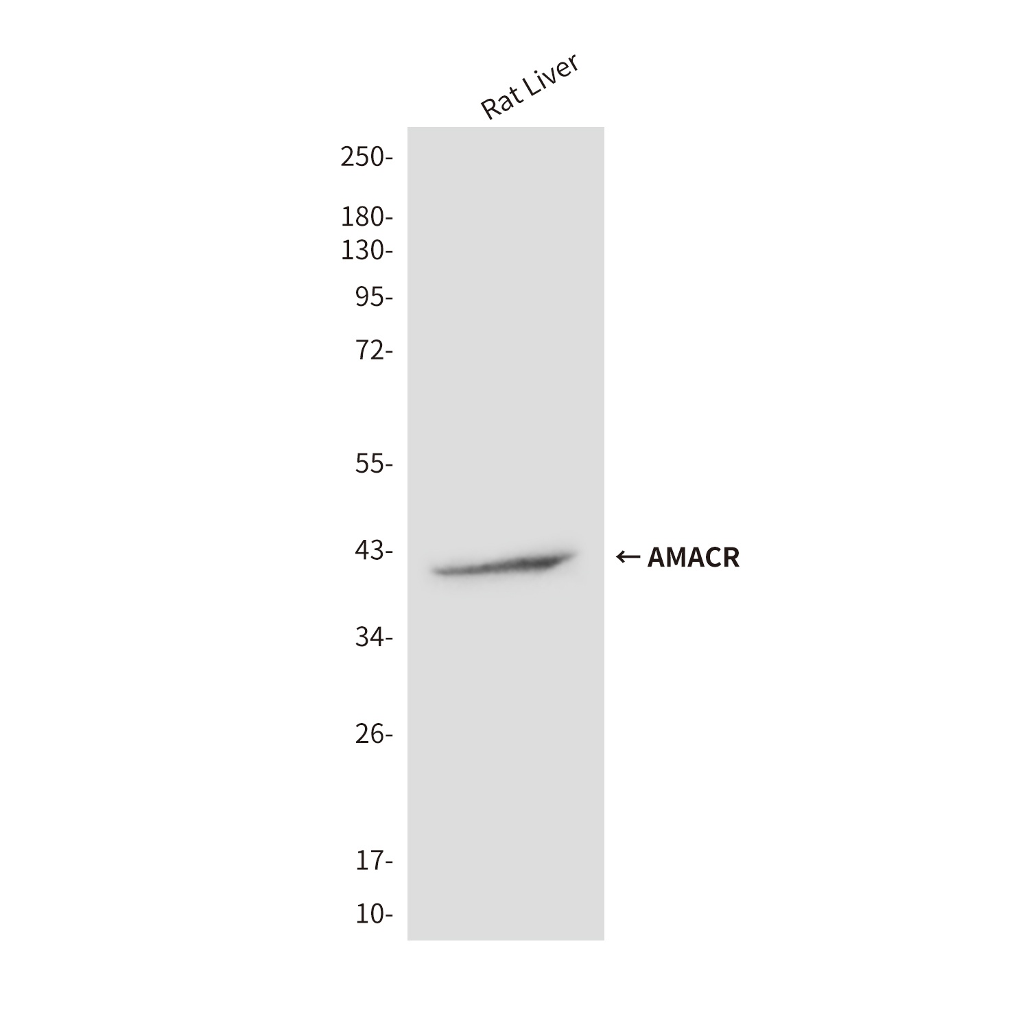 AMACR (2F3) Mouse mAb
