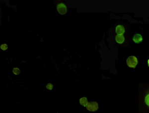 AMACR (2F3) Mouse mAb