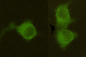 Mannose Phosphate Isomerase (4G9) Mouse mAb