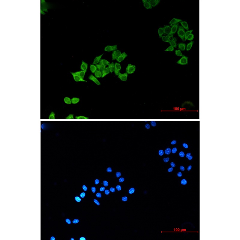 ABCB5 (8D2) Mouse mAb