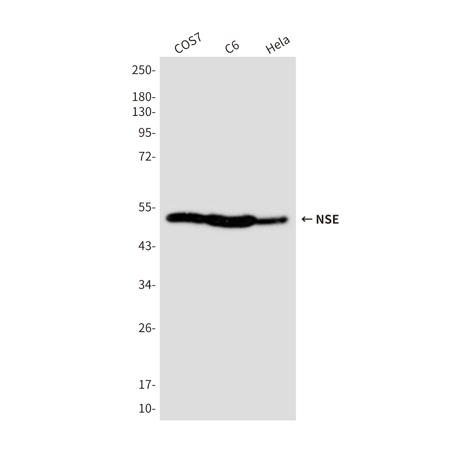 NSE (4C7) Mouse mAb