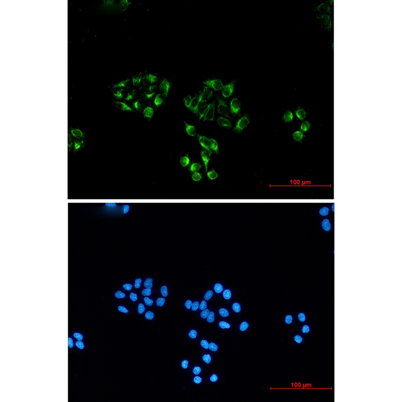 NSE (4C7) Mouse mAb