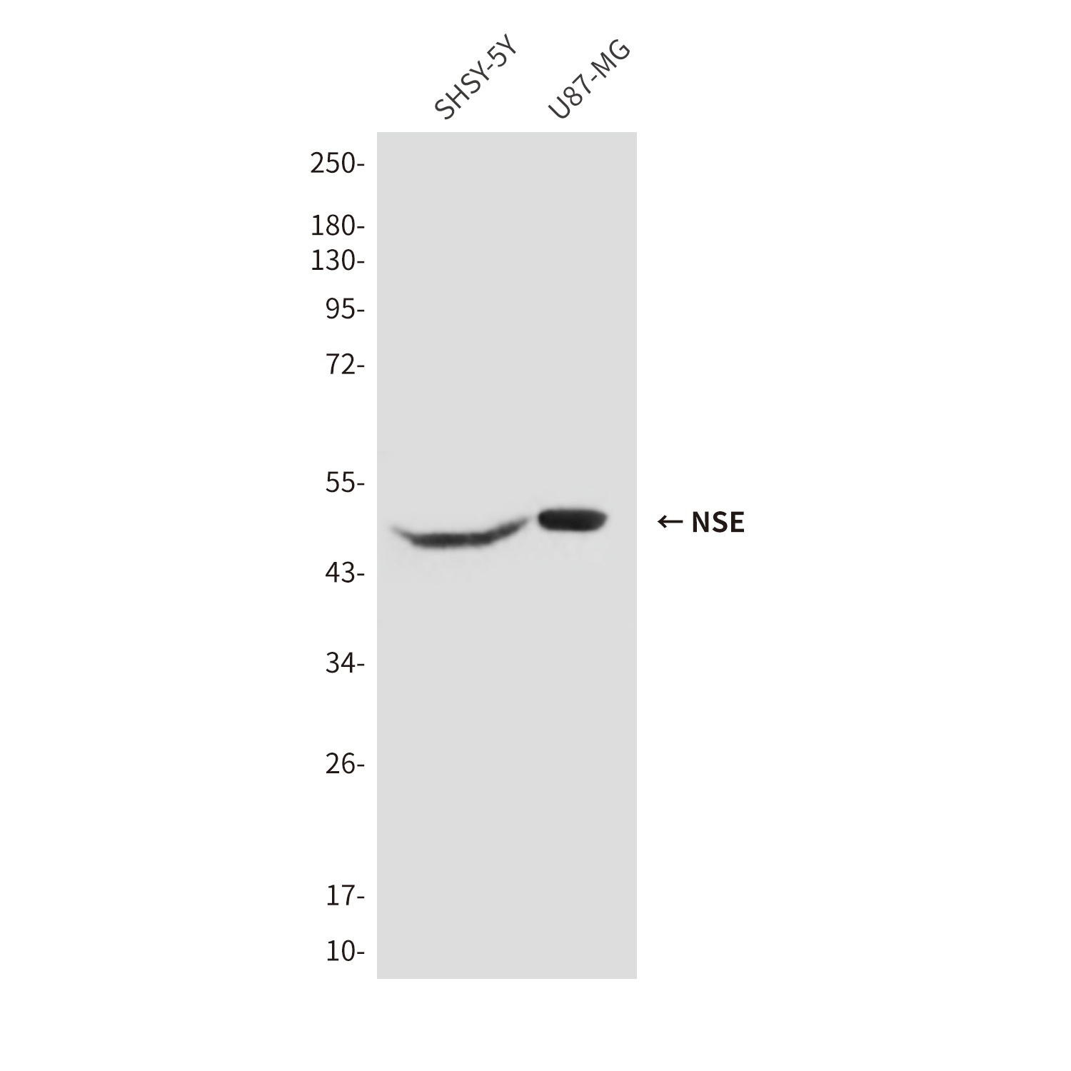 NSE (1H8) Mouse mAb