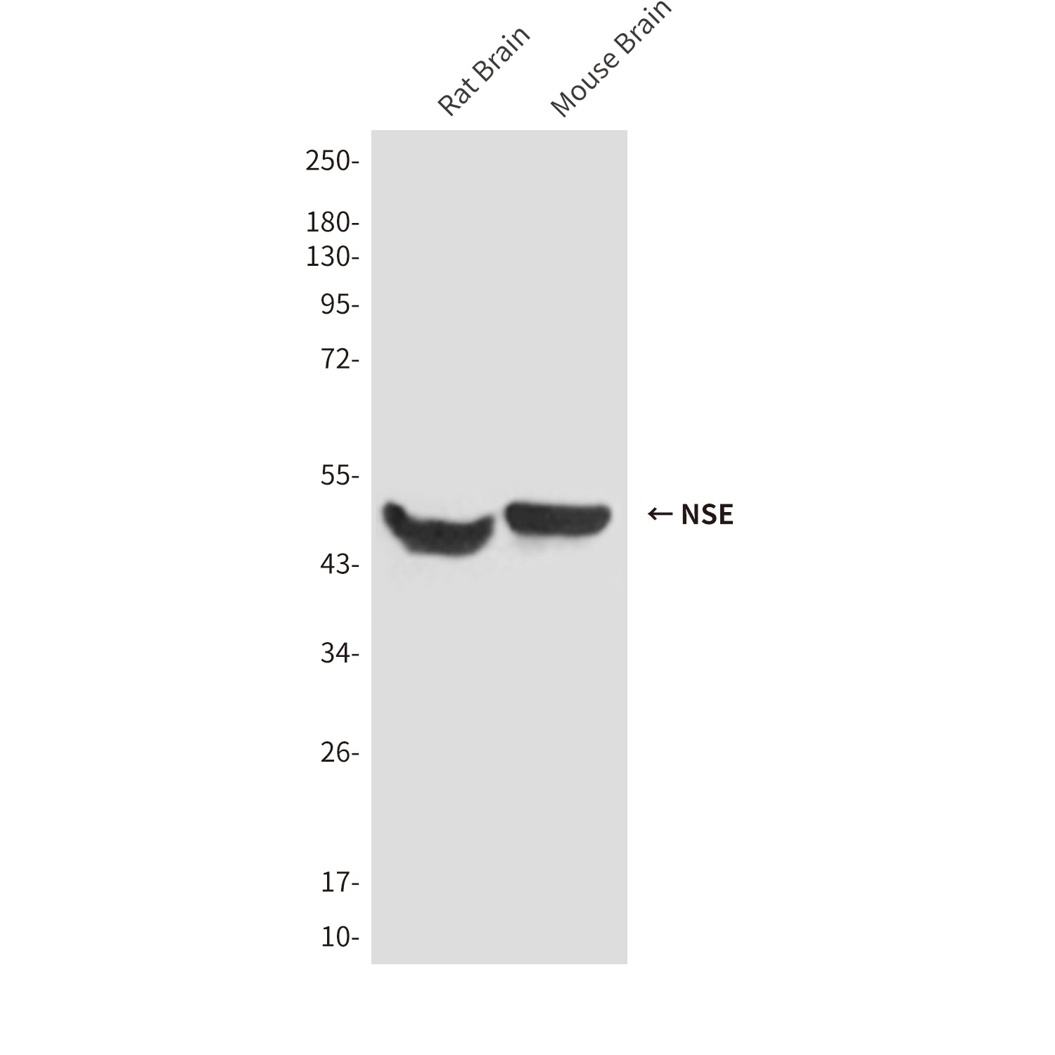 NSE (1H8) Mouse mAb