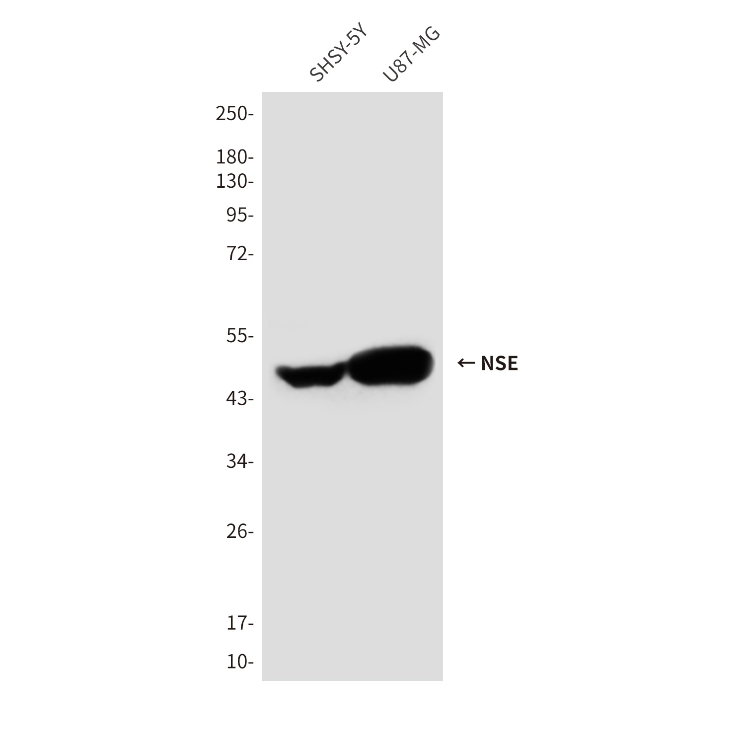 NSE (1G7) Mouse mAb