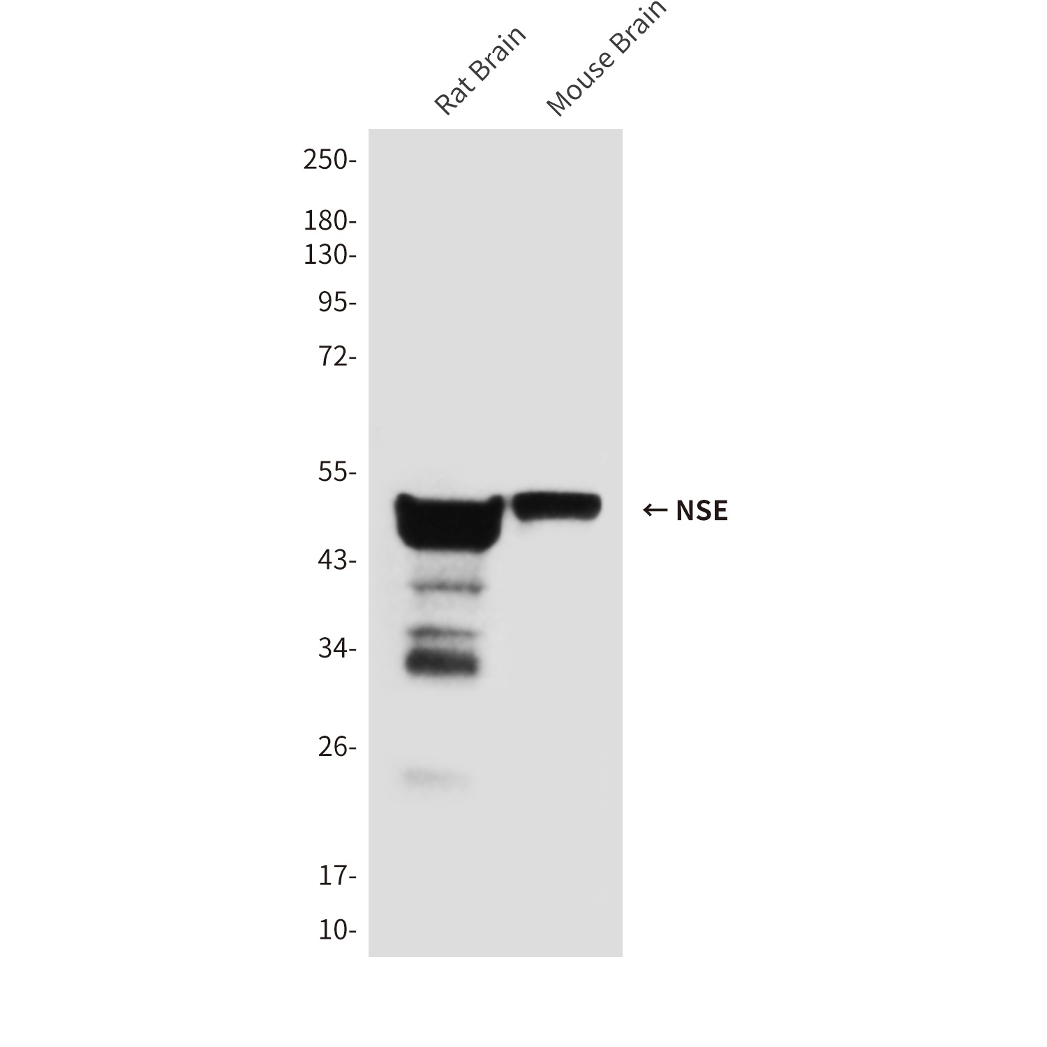 NSE (1G7) Mouse mAb