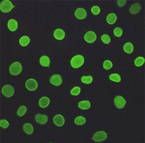 Lamin A/C (5D12) Mouse mAb