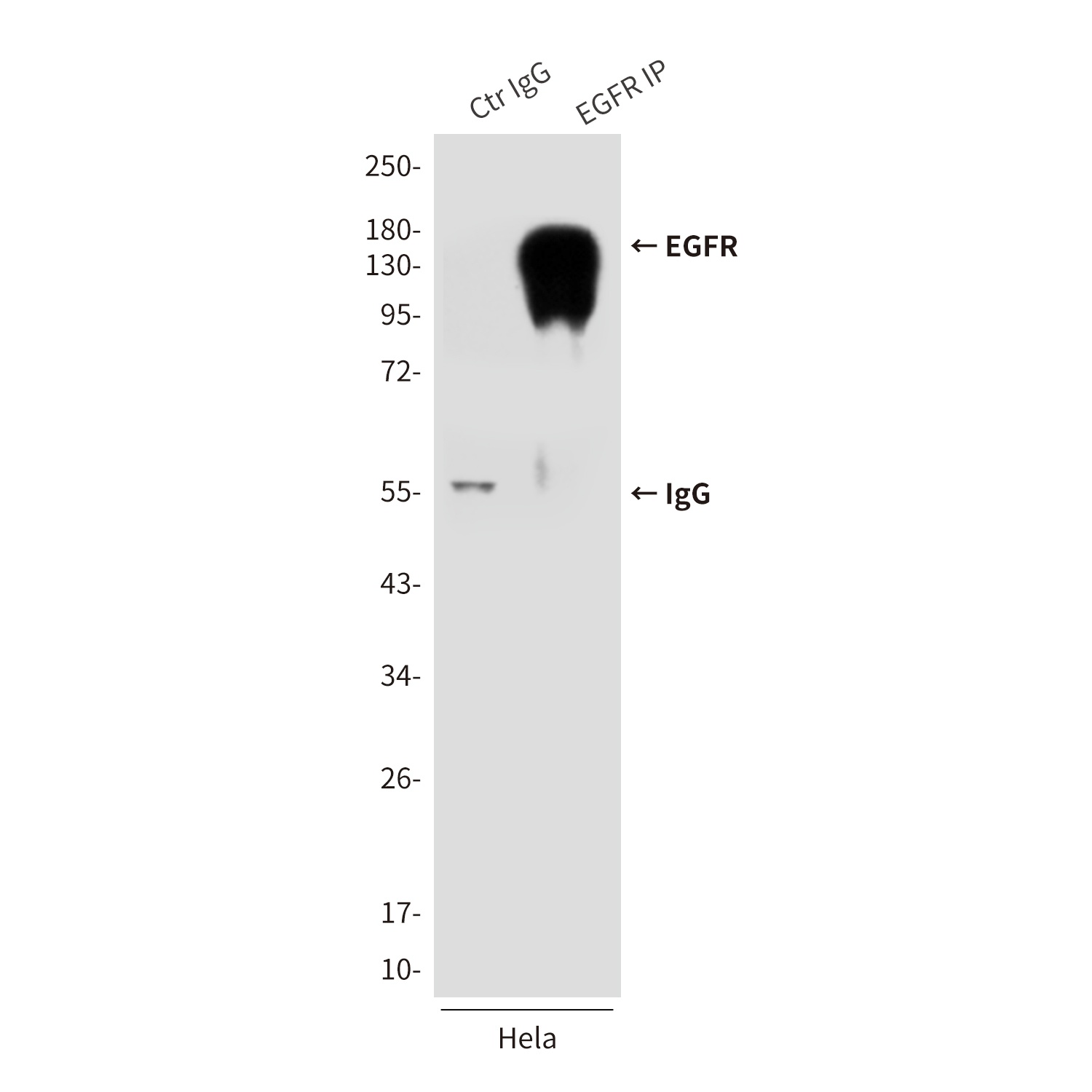 EGFR (5E10) Mouse mAb