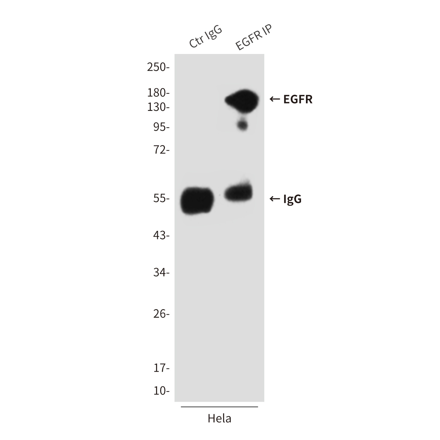 EGFR (1A11) Mouse mAb