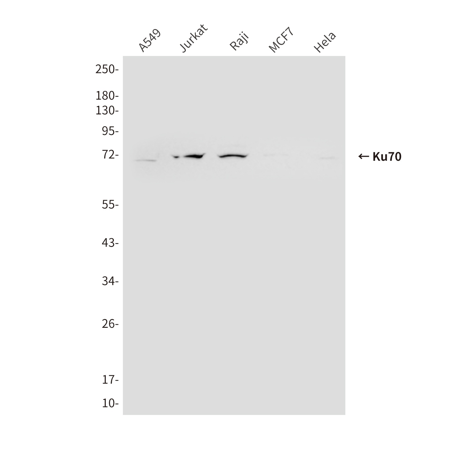 Ku70 (6H10) Mouse mAb