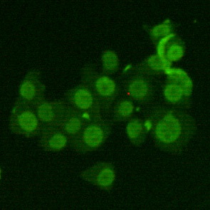 Ku70 (6H10) Mouse mAb