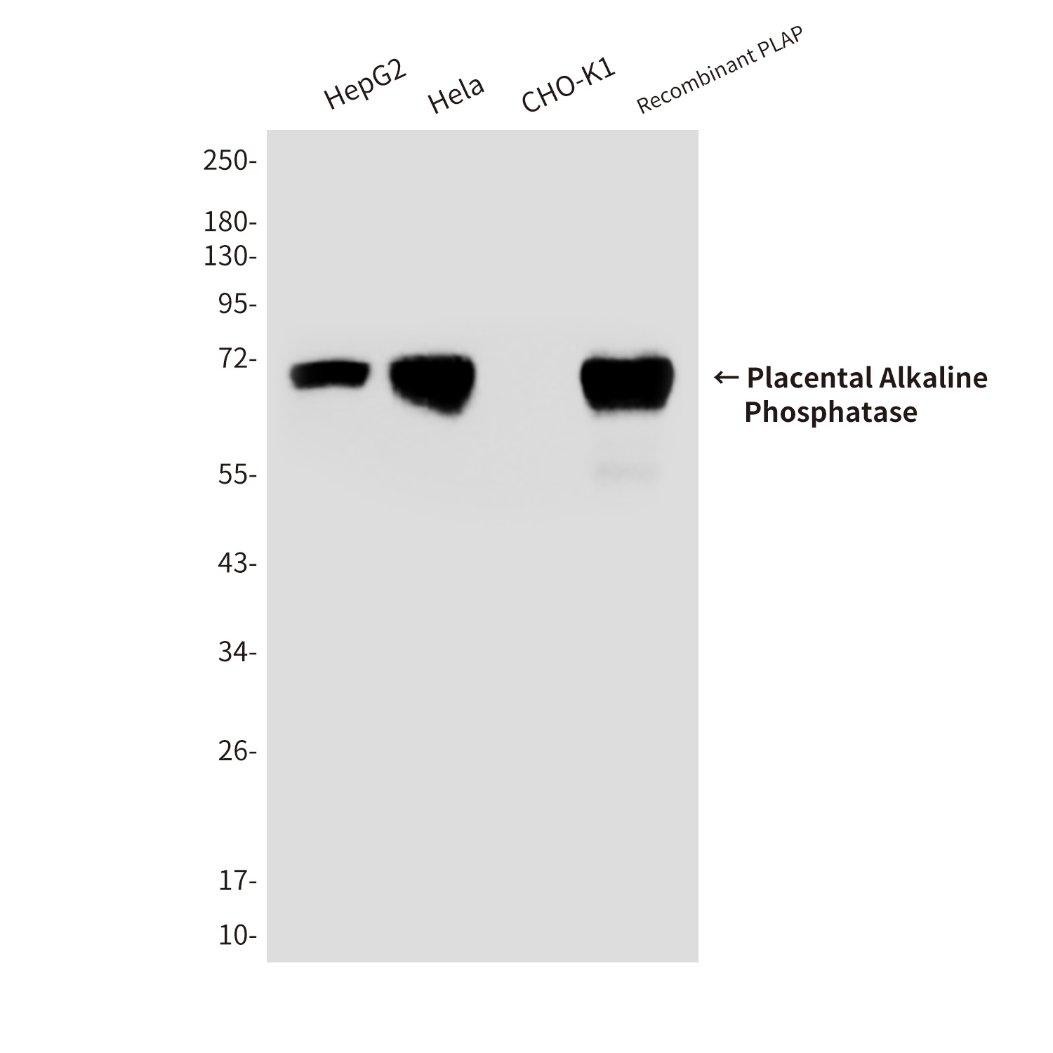 Placental Alkaline Phosphatase Mouse mAb