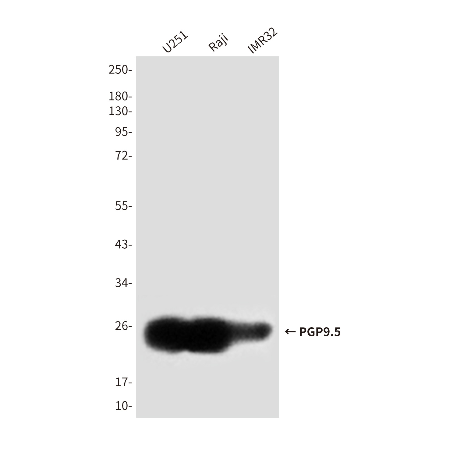 PGP9.5 (7B8G5E7) Mouse mAb