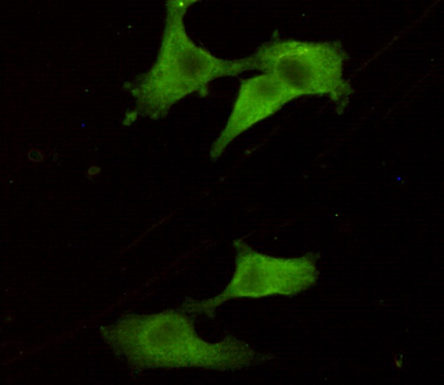 PGP9.5 (7B8G5E7) Mouse mAb