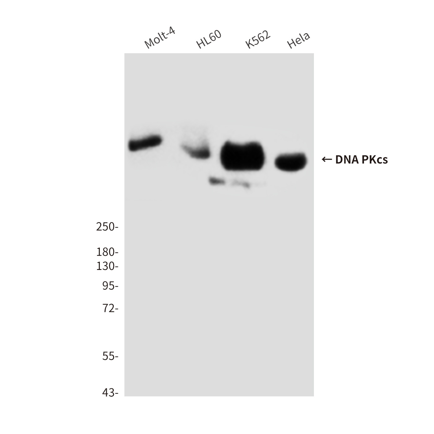 DNA PKcs (8D3) Mouse mAb