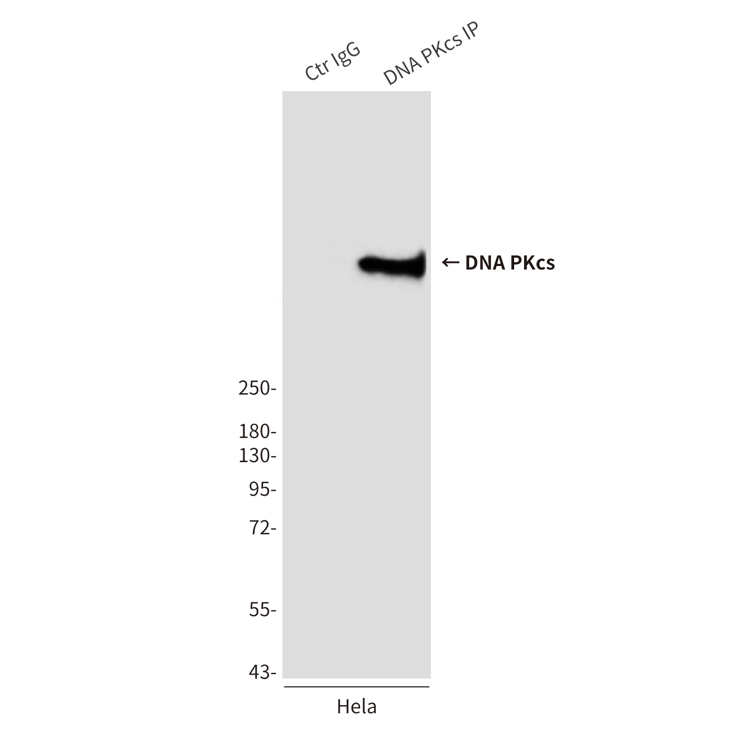 DNA PKcs (8D3) Mouse mAb